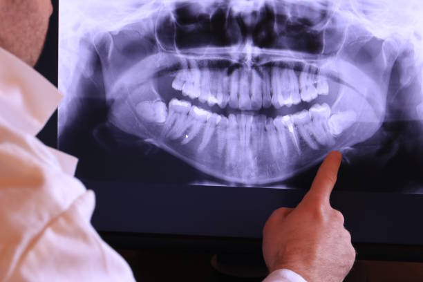 Best Tooth Infection Emergency Dentist  in Tilton Northfield, NH