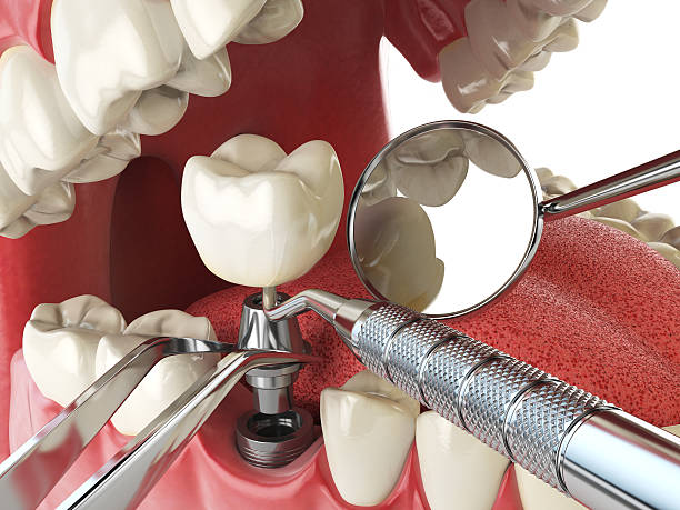 Best Emergency Dental Clinic in NH
